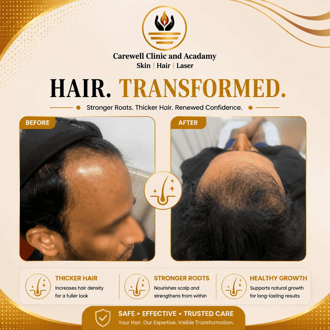 Hair treatment client result 4